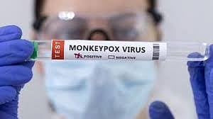 PTI : Pakistan mpox outbreak.(Representational image) |